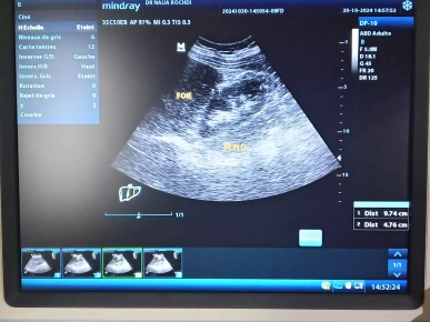 Écho Mindray DP‑10 بحالة ممتازة مع Chariot وSonde Convex 2–6 MHz