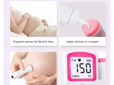 Doppler fœtal LCD 3.0MHz, détecteur de fréquence cardiaque prénat