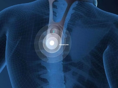 correcteur de posture dorsal intelligent