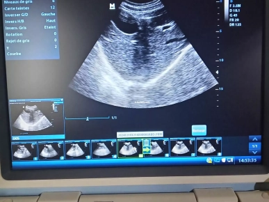 Écho Mindray DP‑10 بحالة ممتازة مع Chariot وSonde Convex 2–6 MHz