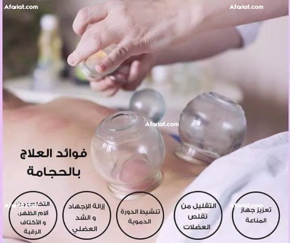 Le traitement par ventouses “Al- Hijama”